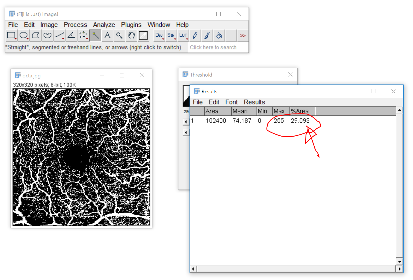 imagej threshold to selection